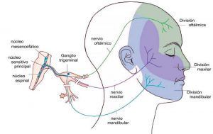 Neuralgia del trigémino Neuralgia del trigémino