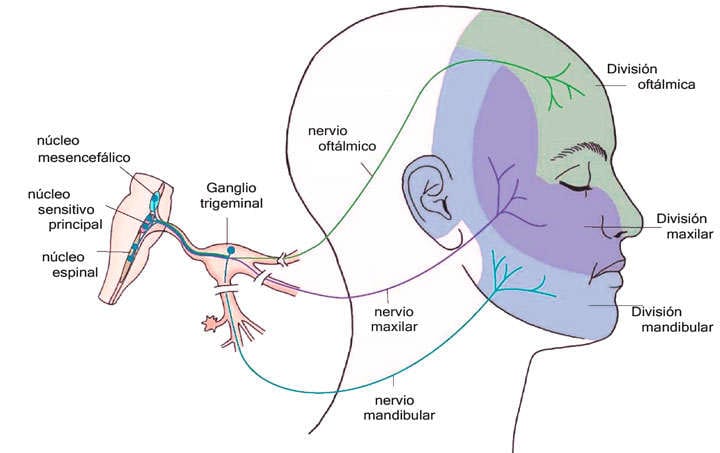 Neuralgia del trigémino