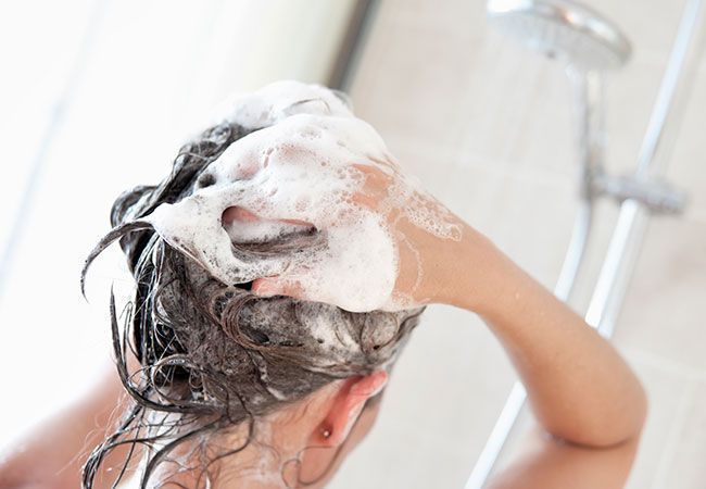 Causas y remedios para combatir la caspa de forma natural
