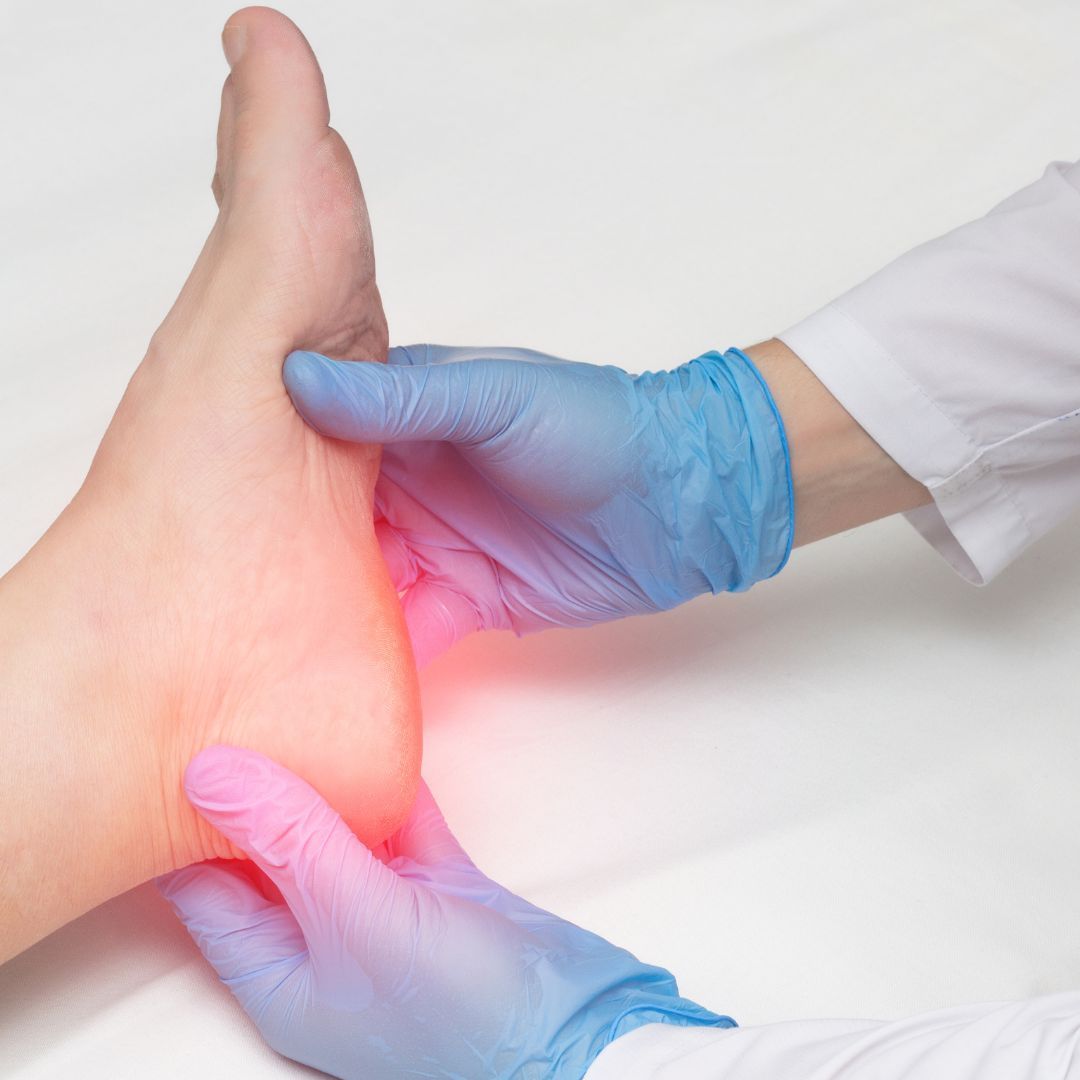 Fascitis plantar: síntomas, causas y remedios