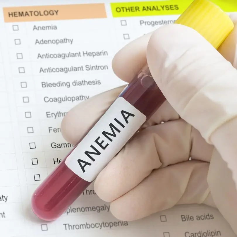 Anemia: causas y tratamiento