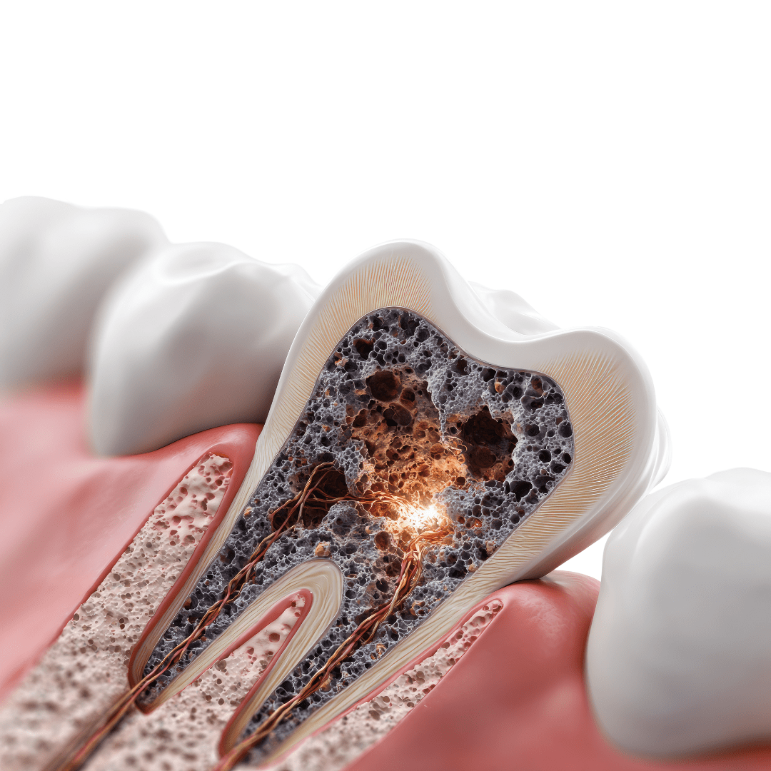 Remedios naturales para la sensibilidad dental